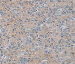 RASA4 Antibody in Immunohistochemistry (Paraffin) (IHC (P))