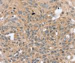 RASGEF1A Antibody in Immunohistochemistry (Paraffin) (IHC (P))