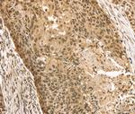 STAG2 Polyclonal Antibody