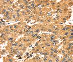 SH3KBP1 Antibody in Immunohistochemistry (Paraffin) (IHC (P))