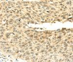 SHPRH Polyclonal Antibody