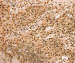 SNX8 Antibody in Immunohistochemistry (Paraffin) (IHC (P))
