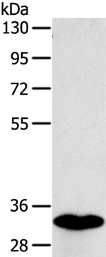 SULT1B1 Antibody in Western Blot (WB)