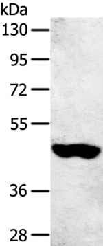 SULT2B1 Antibody in Western Blot (WB)