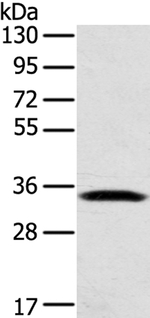 STX11 Antibody in Western Blot (WB)