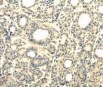 TBC1D22A Polyclonal Antibody