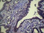 TCEB1 Antibody in Immunohistochemistry (Paraffin) (IHC (P))