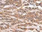 TRIM14 Antibody in Immunohistochemistry (Paraffin) (IHC (P))