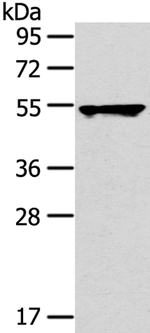 TRIM10 Antibody in Western Blot (WB)