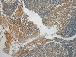TMPRSS11E Antibody in Immunohistochemistry (Paraffin) (IHC (P))
