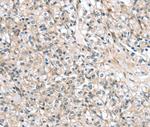 TMPRSS11B Polyclonal Antibody