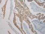 TXNDC3 Polyclonal Antibody