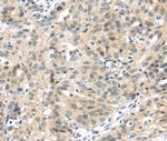 UBL3 Polyclonal Antibody