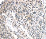 IQGAP2 Antibody in Immunohistochemistry (Paraffin) (IHC (P))