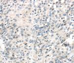 IQGAP2 Antibody in Immunohistochemistry (Paraffin) (IHC (P))