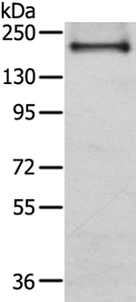 IQGAP2 Antibody in Western Blot (WB)