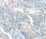 BOK Antibody in Immunohistochemistry (Paraffin) (IHC (P))