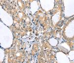 LLGL2 Polyclonal Antibody