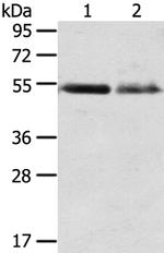 RHCG Antibody in Western Blot (WB)