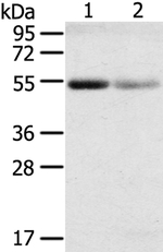 SLC17A1 Polyclonal Antibody