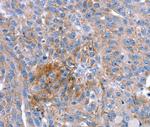 SPATA5L1 Polyclonal Antibody