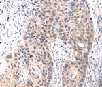 TCERG1L Polyclonal Antibody