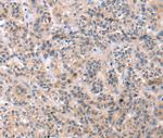 TCERG1L Antibody in Immunohistochemistry (Paraffin) (IHC (P))