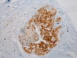 Thrombospondin 2 Antibody in Immunohistochemistry (Paraffin) (IHC (P))