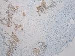 Thrombospondin 2 Antibody in Immunohistochemistry (Paraffin) (IHC (P))