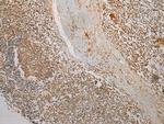TMPRSS11F Polyclonal Antibody