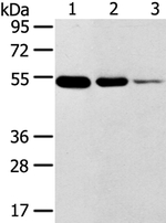 TMPRSS11F Antibody in Western Blot (WB)