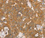 TPD52L2 Antibody in Immunohistochemistry (Paraffin) (IHC (P))