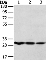 TPD52L2 Antibody in Western Blot (WB)