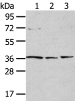 TPST1 Polyclonal Antibody