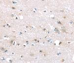 TTI1 Antibody in Immunohistochemistry (Paraffin) (IHC (P))