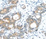TUSC1 Polyclonal Antibody