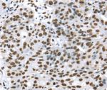 UAP56 Polyclonal Antibody