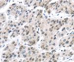 UAP56 Antibody in Immunohistochemistry (Paraffin) (IHC (P))