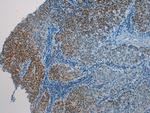 HAUS7 Polyclonal Antibody