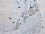 HAUS7 Antibody in Immunohistochemistry (Paraffin) (IHC (P))