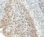 NSD1 Antibody in Immunohistochemistry (Paraffin) (IHC (P))