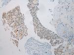 UTS2B Polyclonal Antibody