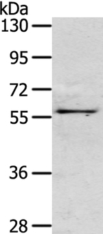 OLFM3 Antibody in Western Blot (WB)