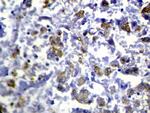 RASAL1 Polyclonal Antibody