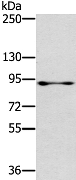 RASAL1 Antibody in Western Blot (WB)