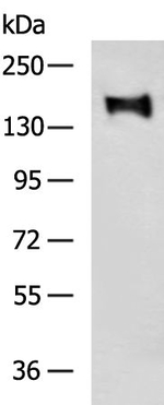 RASAL2 Antibody in Western Blot (WB)