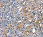 RNF7 Polyclonal Antibody