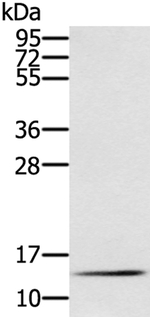 RNF7 Antibody in Western Blot (WB)