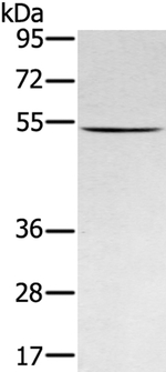 RNF14 Antibody in Western Blot (WB)