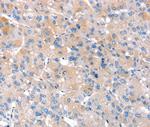 RNF214 Polyclonal Antibody